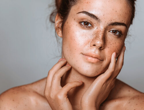 Despigmentación Cutánea: Preocupaciones y Objeciones Comunes de los Clientes